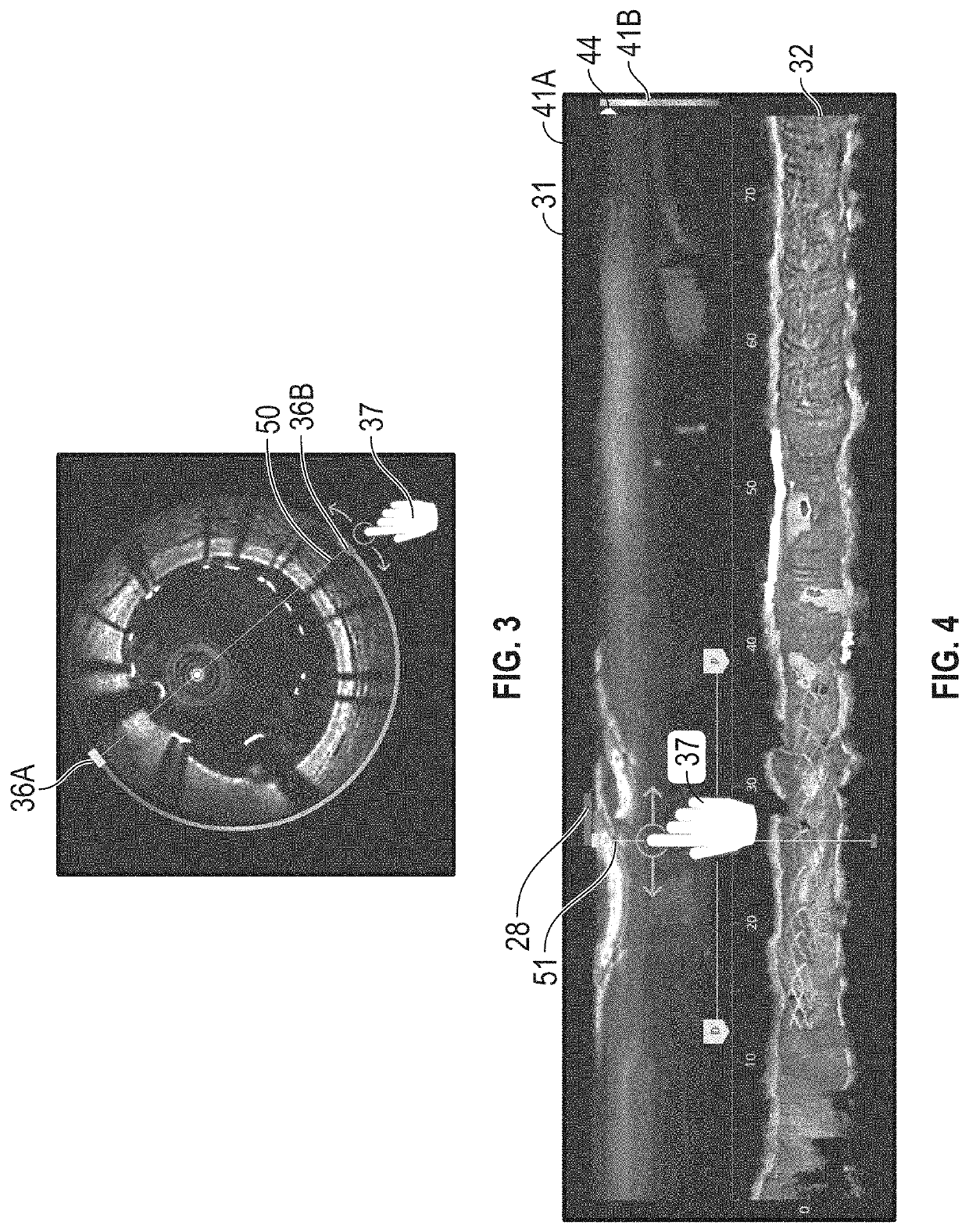 Devices, systems, and methods to emphasize regions of interest across multiple imaging modalities