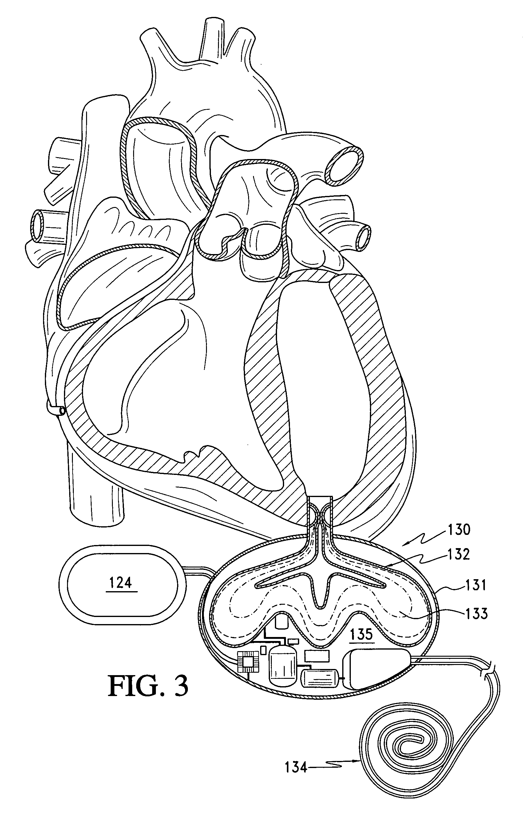 Nondestructive fluid transfer device