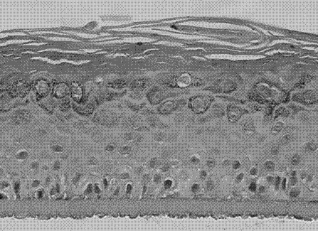 Gas-liquid level growth medium for melanin and keratinocytes for constructing reconstituted skin model