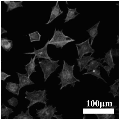 Preparation method and application of composite hydrogel, composite hydrogel repair material and preparation method thereof