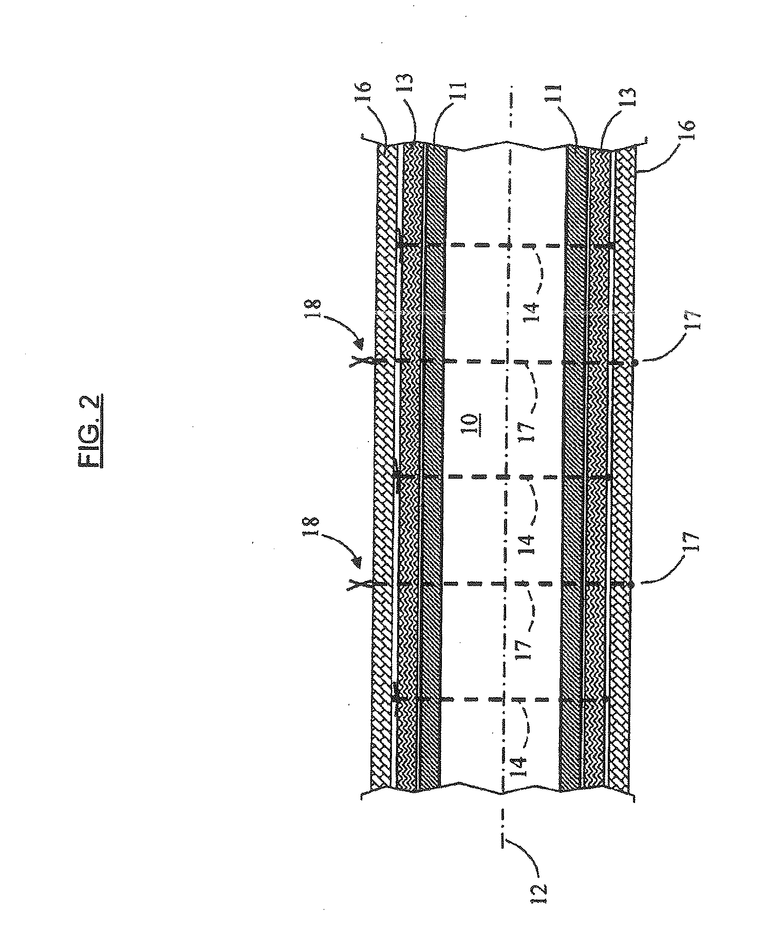 Leak detection device, and coating intended for a fluid transport or storage member and comprising said detection device