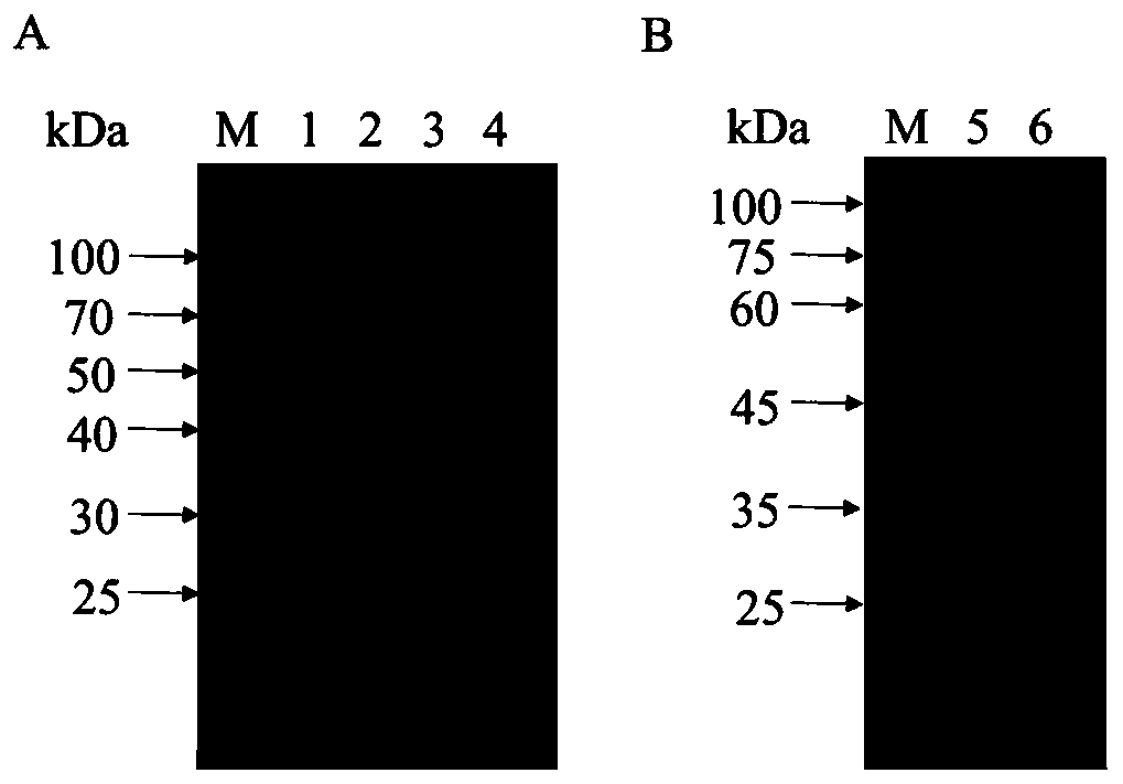 B cell epitope polypeptide of serine protease inhibitor (Ts-WM5) in larvae phase of trichina muscle, hybridoma cell strain, monoclonal antibody and application thereof