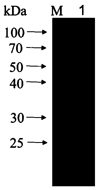 B cell epitope polypeptide of serine protease inhibitor (Ts-WM5) in larvae phase of trichina muscle, hybridoma cell strain, monoclonal antibody and application thereof