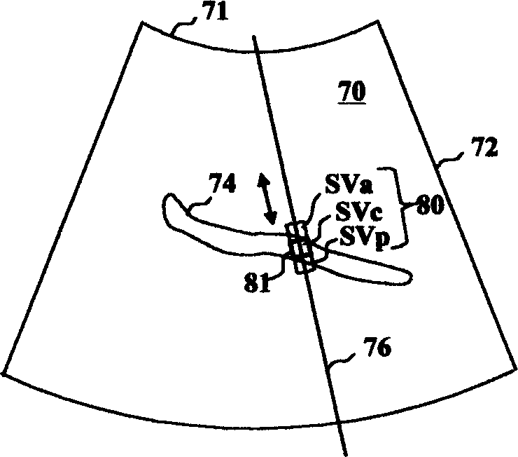 Ultrasonic Doppler diagnosis system with automatic following function