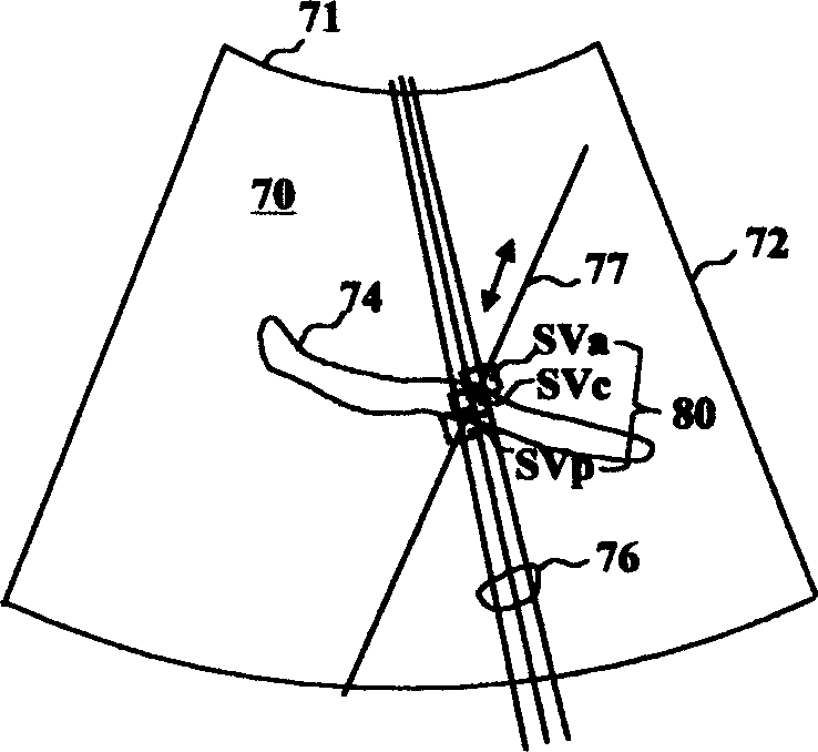 Ultrasonic Doppler diagnosis system with automatic following function