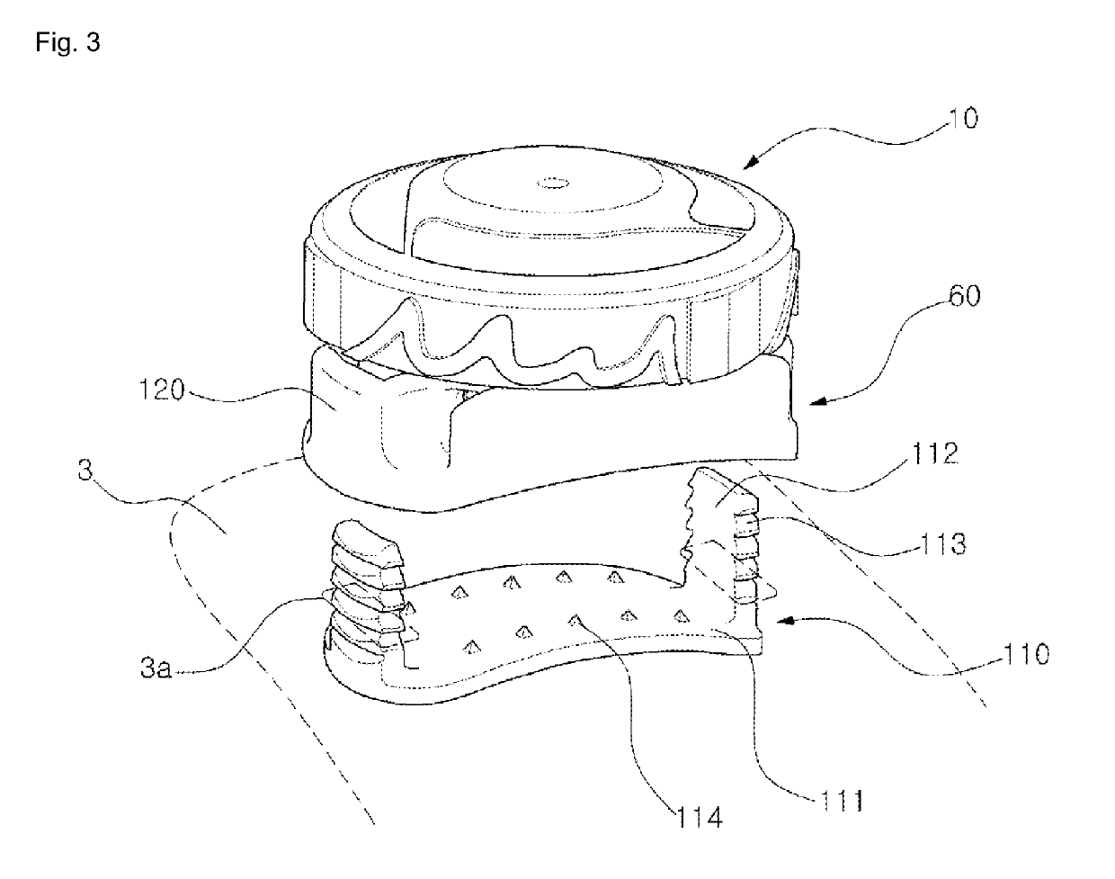 Wire tightening device and providing method therefor