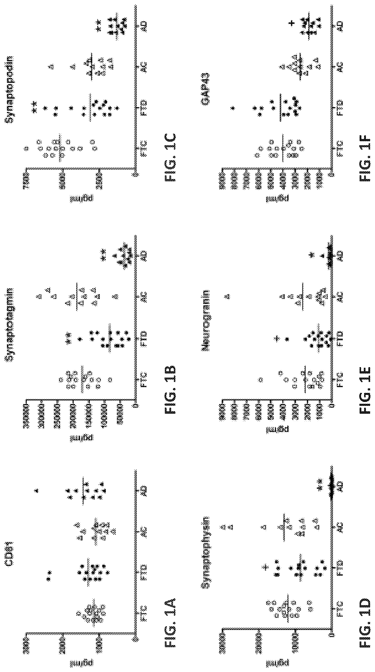 Synaptic protein biomarkers and differential diagnosis of alzheimer's disease and other neurodegenerative disorders