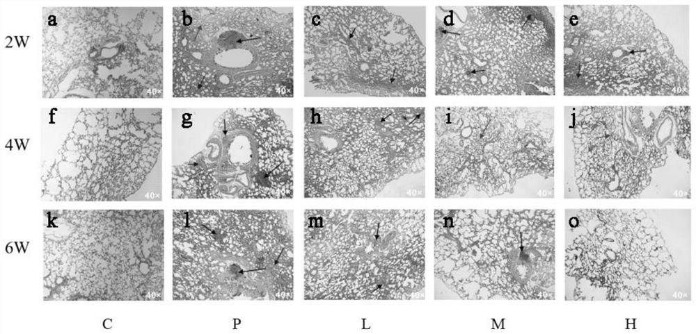 Preparation method and application of bulbus fritillariae cirrhosae extract