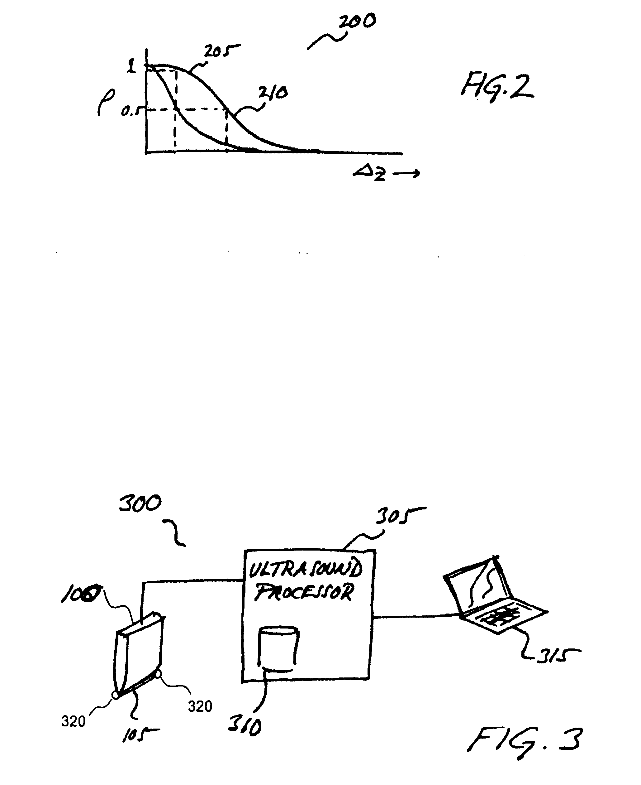 Robust and accurate freehand 3D ultrasound