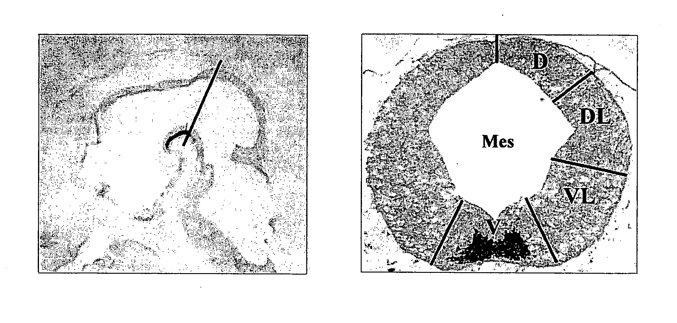 Specific Marker Lmx1a on Dopaminergic Neurons