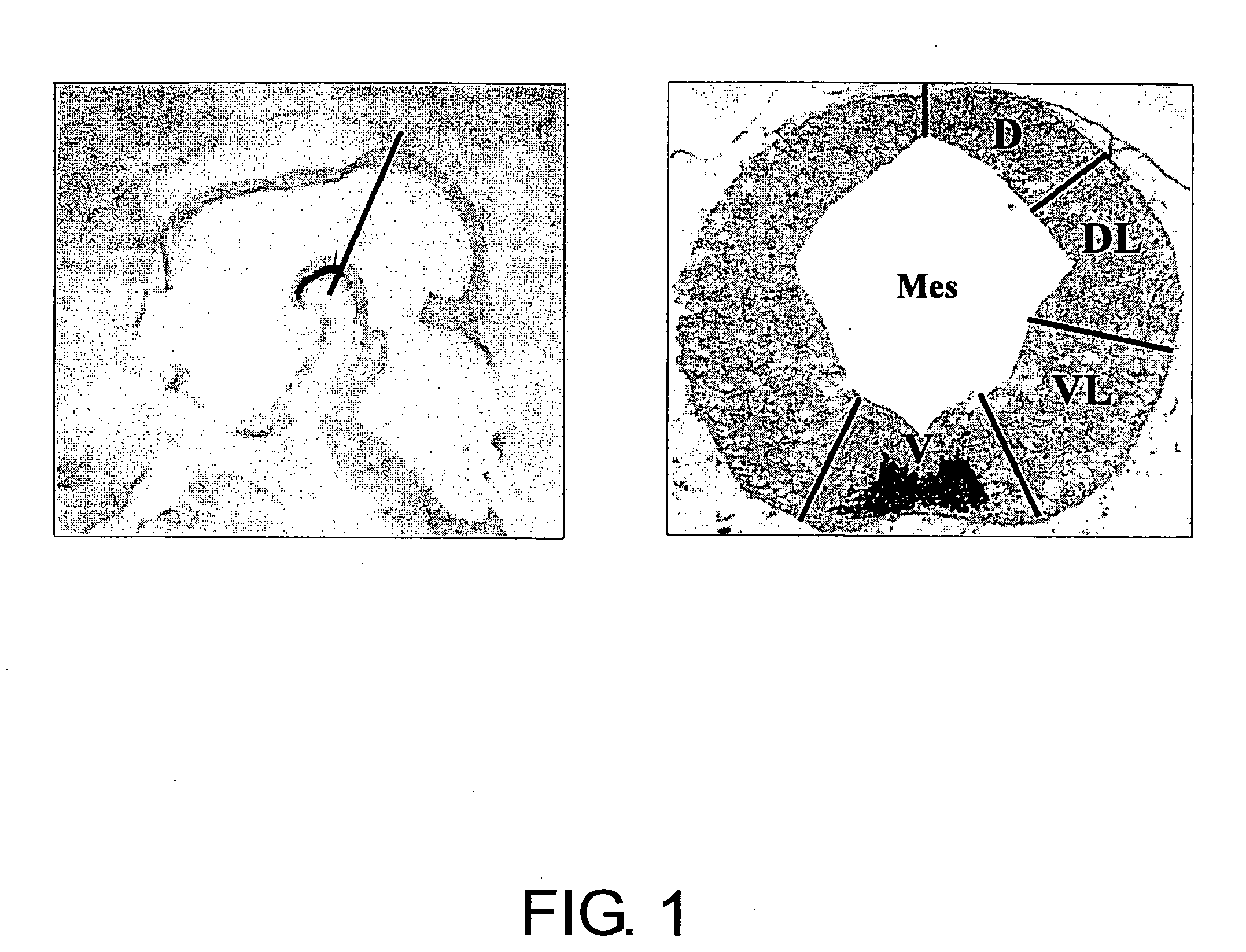 Specific Marker Lmx1a on Dopaminergic Neurons