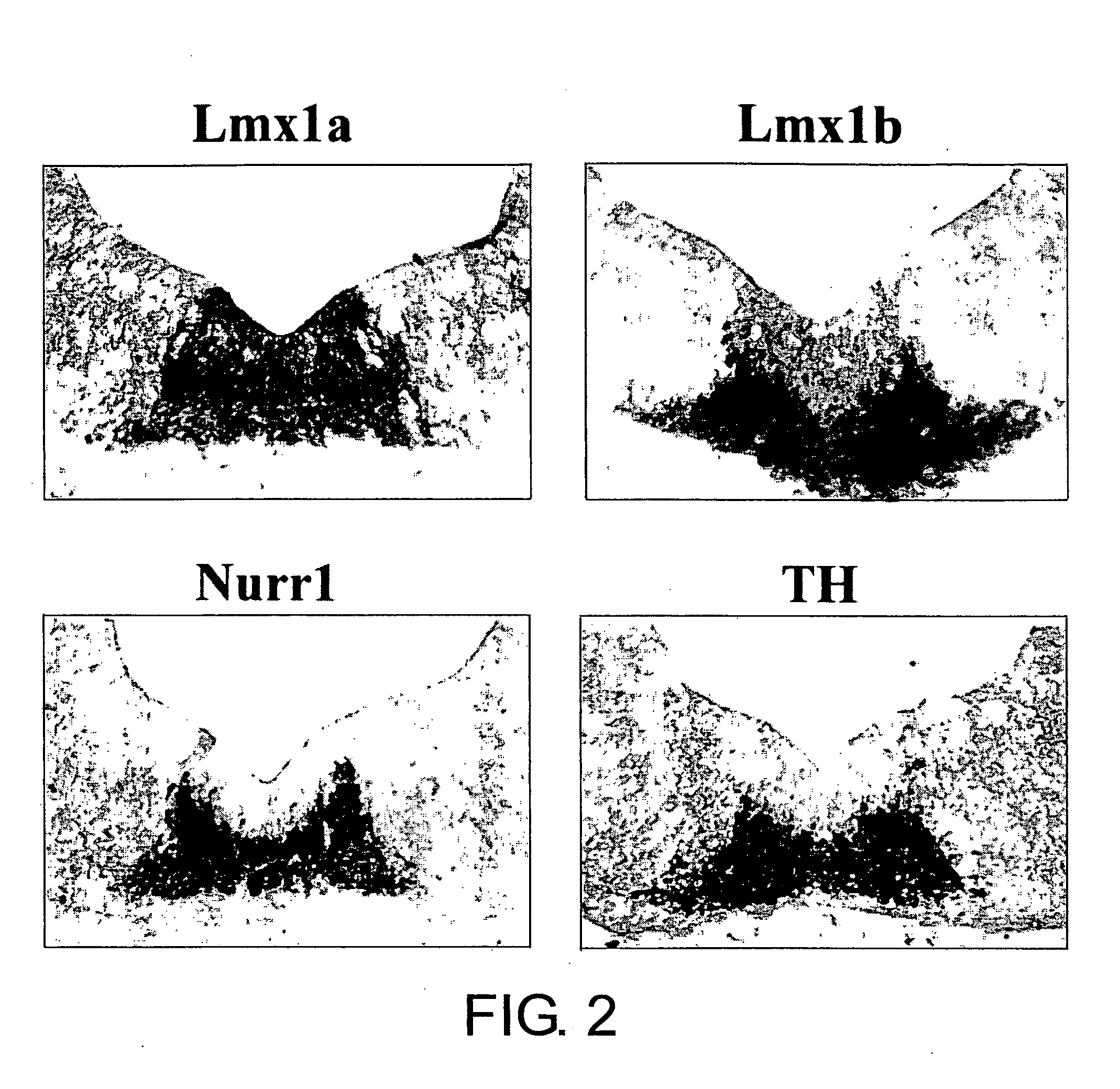 Specific Marker Lmx1a on Dopaminergic Neurons