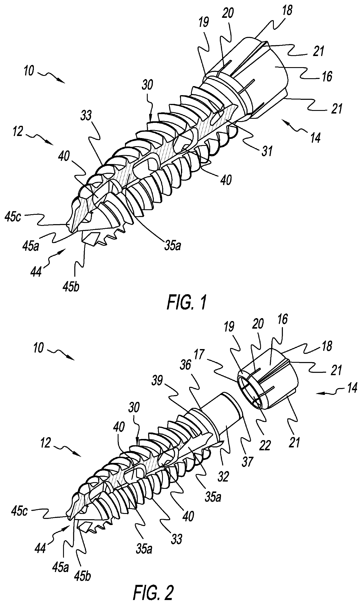 Bone Screw Implant for Sacroiliac Joint Fusion