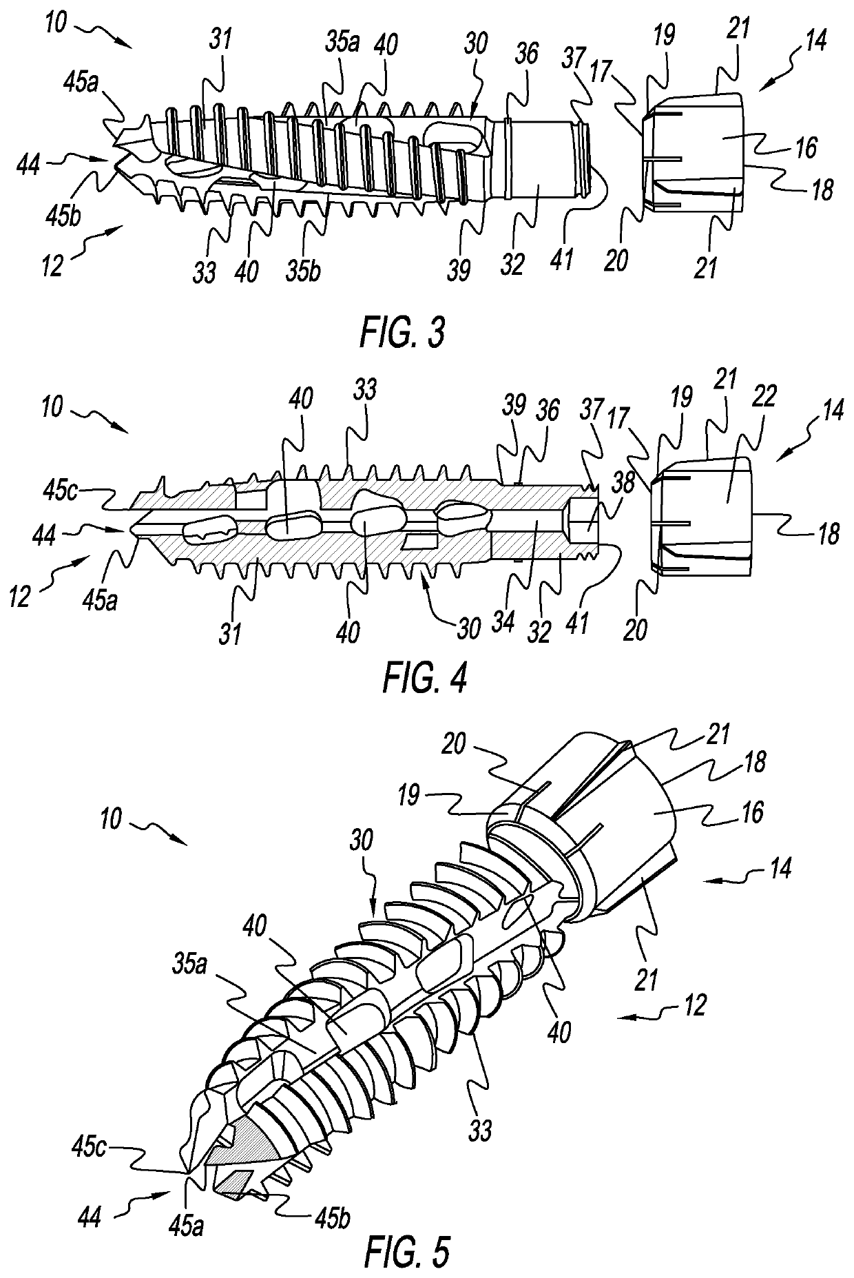 Bone Screw Implant for Sacroiliac Joint Fusion