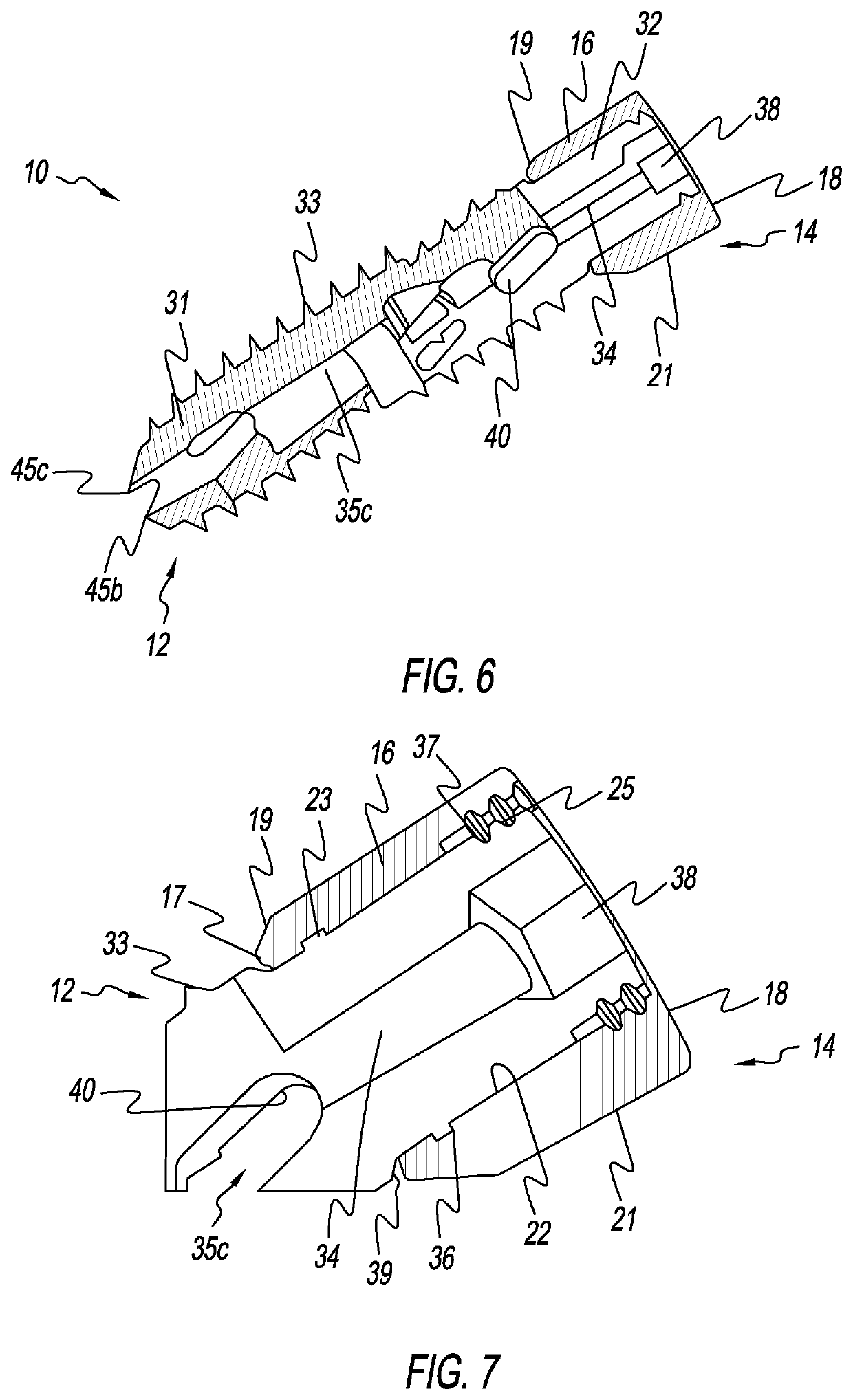 Bone Screw Implant for Sacroiliac Joint Fusion