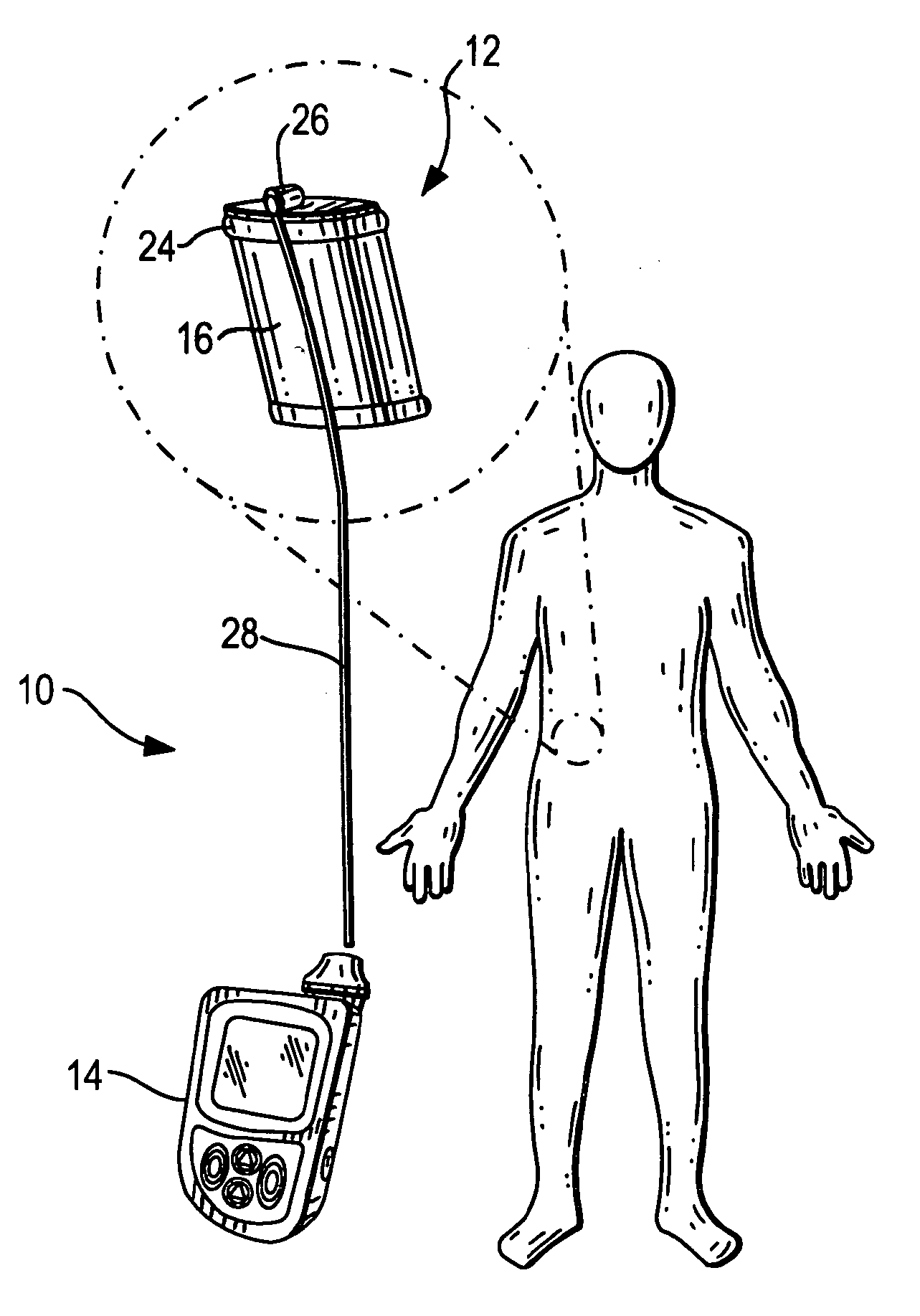 Therapeutic hybrid implantable devices