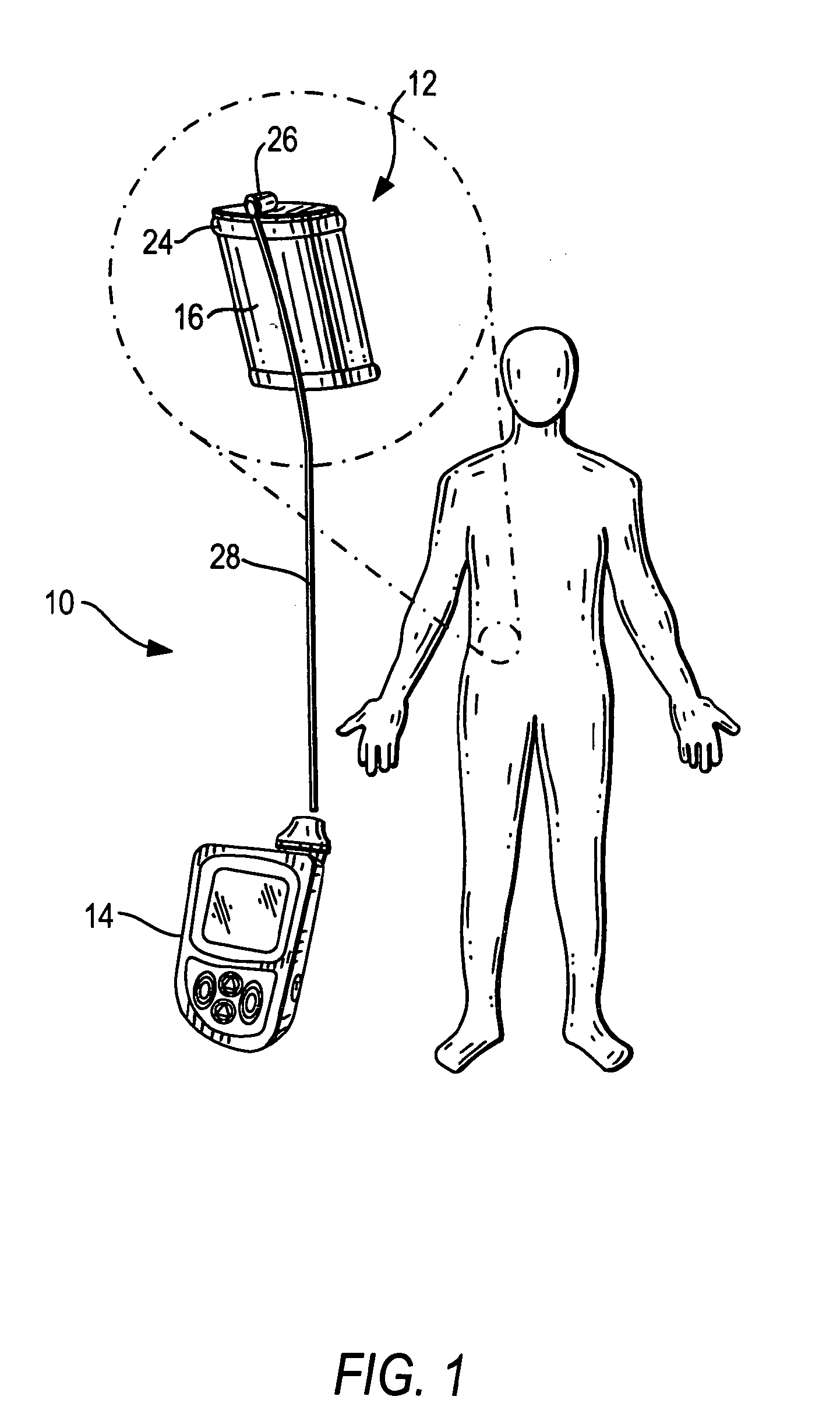 Therapeutic hybrid implantable devices