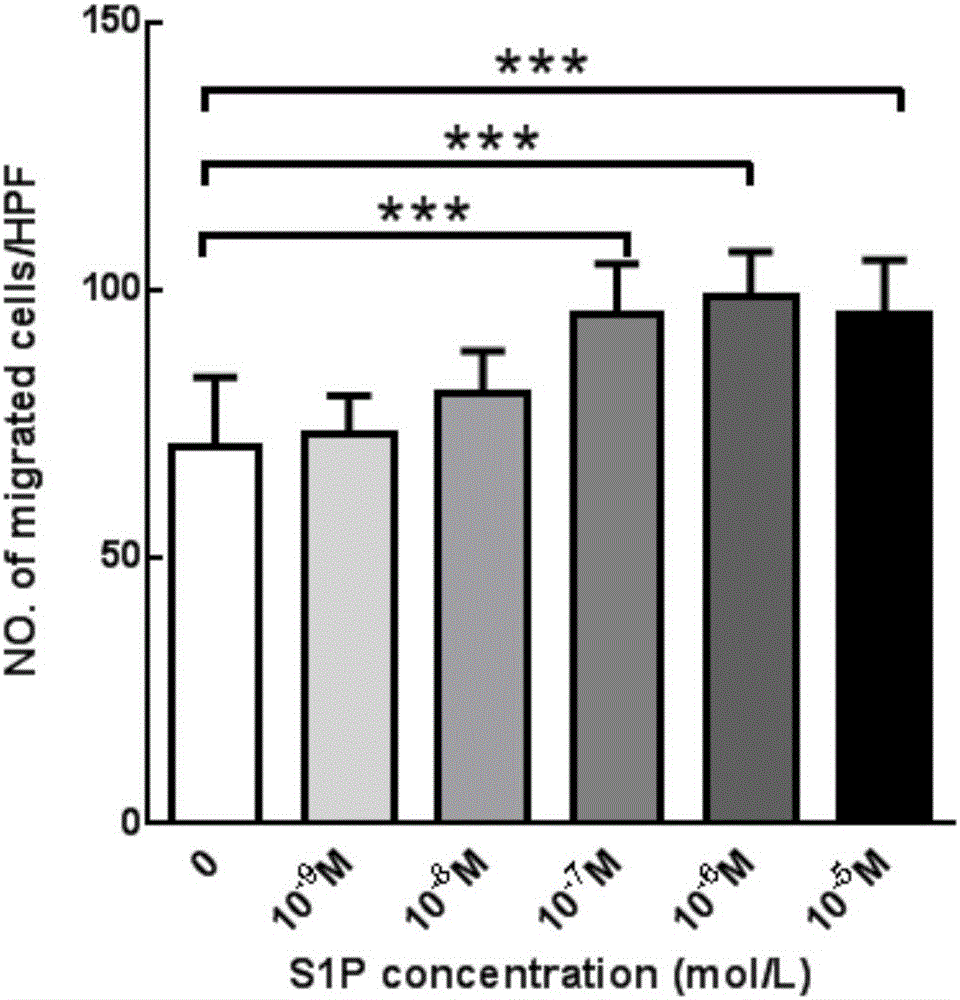 PLGA-S1P nanometer material and preparation method of PLGA-S1P nanometer coating stent