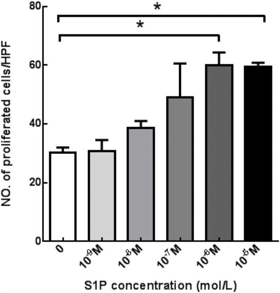 PLGA-S1P nanometer material and preparation method of PLGA-S1P nanometer coating stent