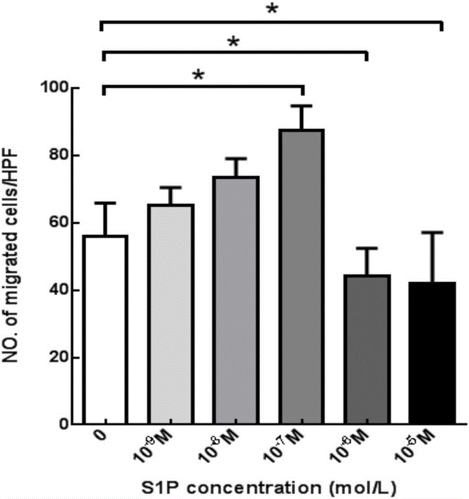 PLGA-S1P nanometer material and preparation method of PLGA-S1P nanometer coating stent