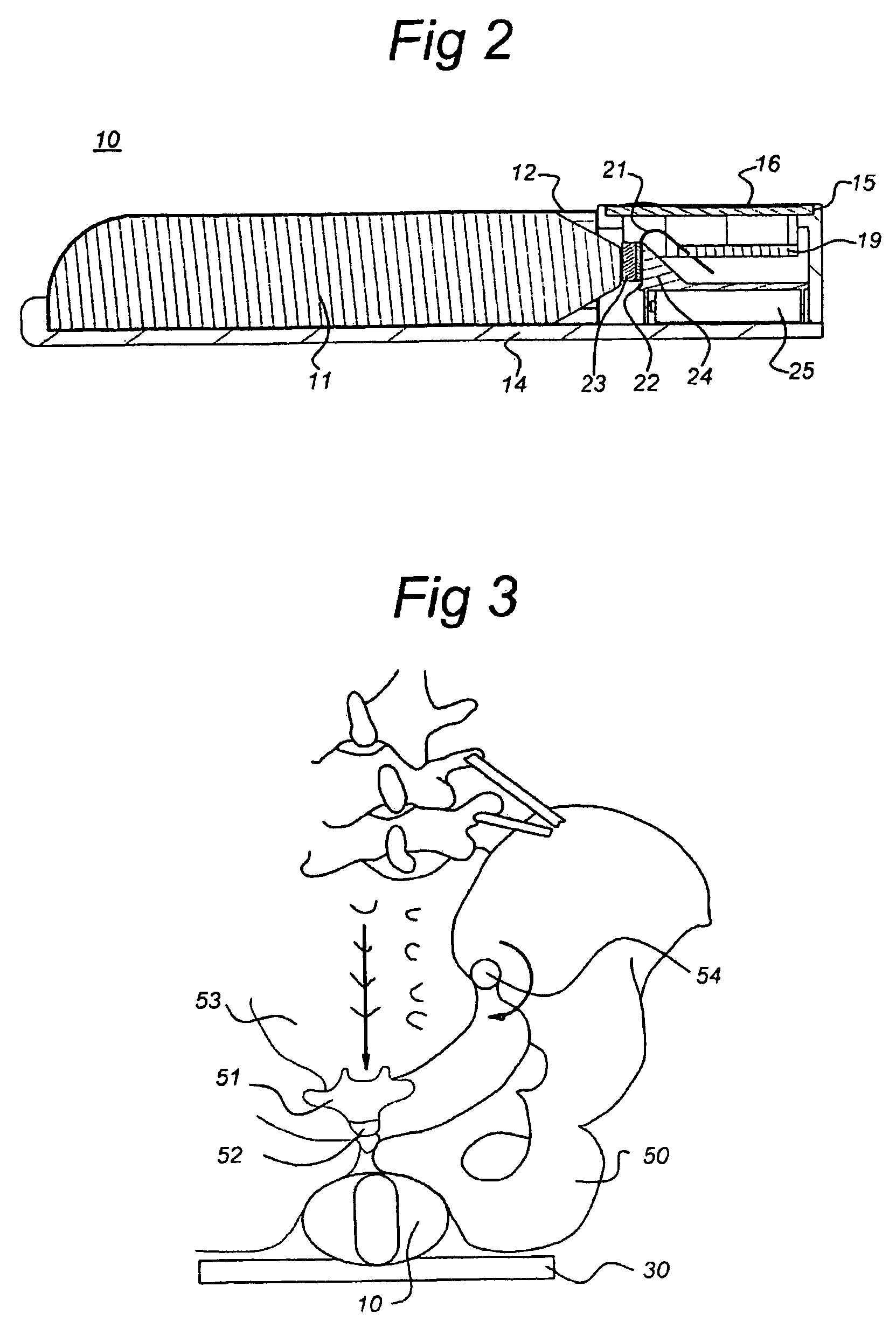 Pelvic floor training device