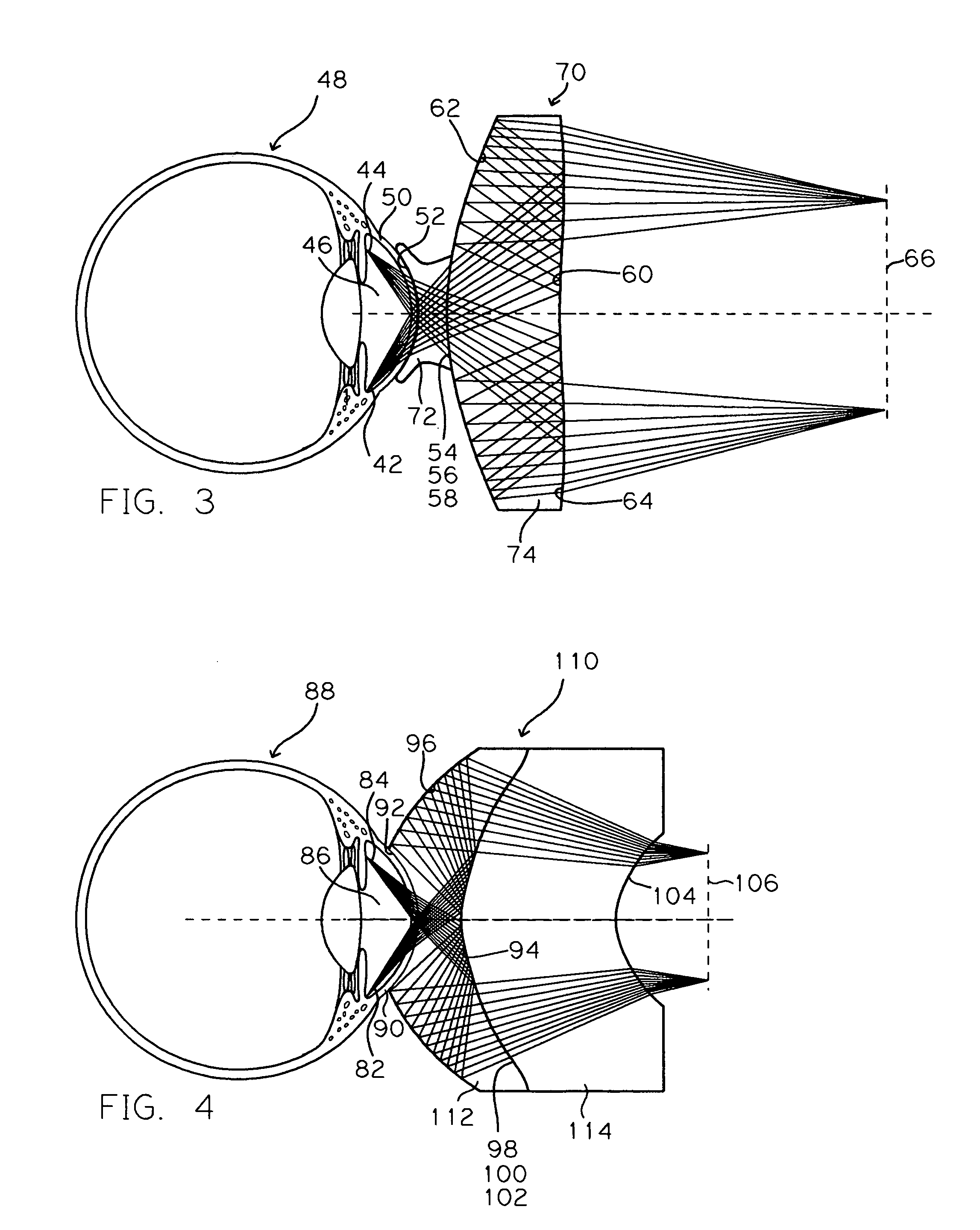 Real image forming eye examination lens utilizing two reflecting surfaces