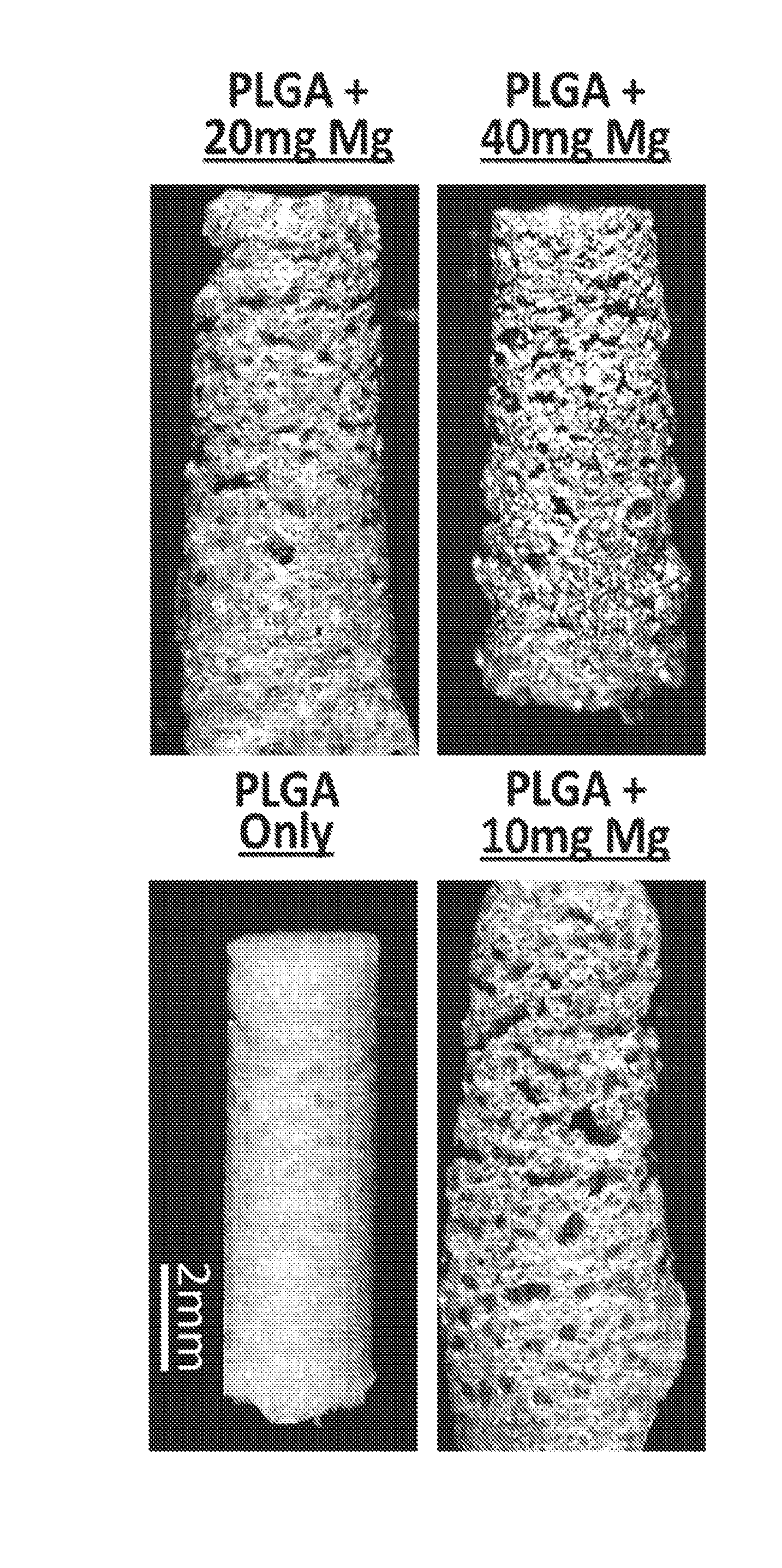 Magnesium/polymer composite-containing scaffolds to enhance tissue regeneration