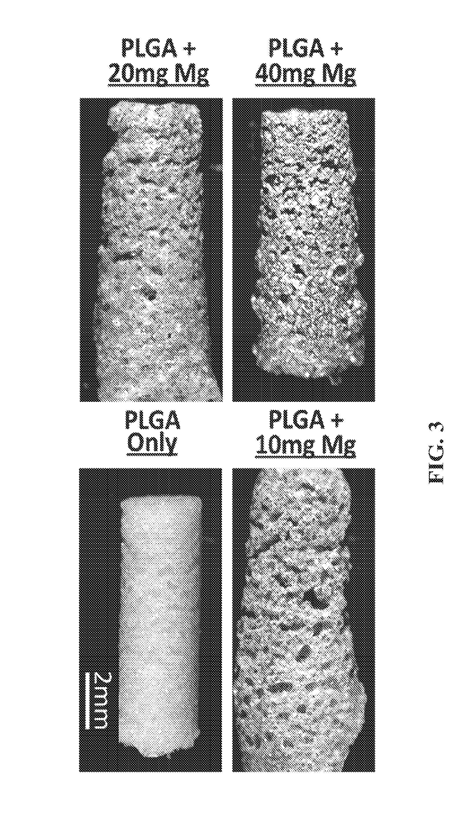 Magnesium/polymer composite-containing scaffolds to enhance tissue regeneration