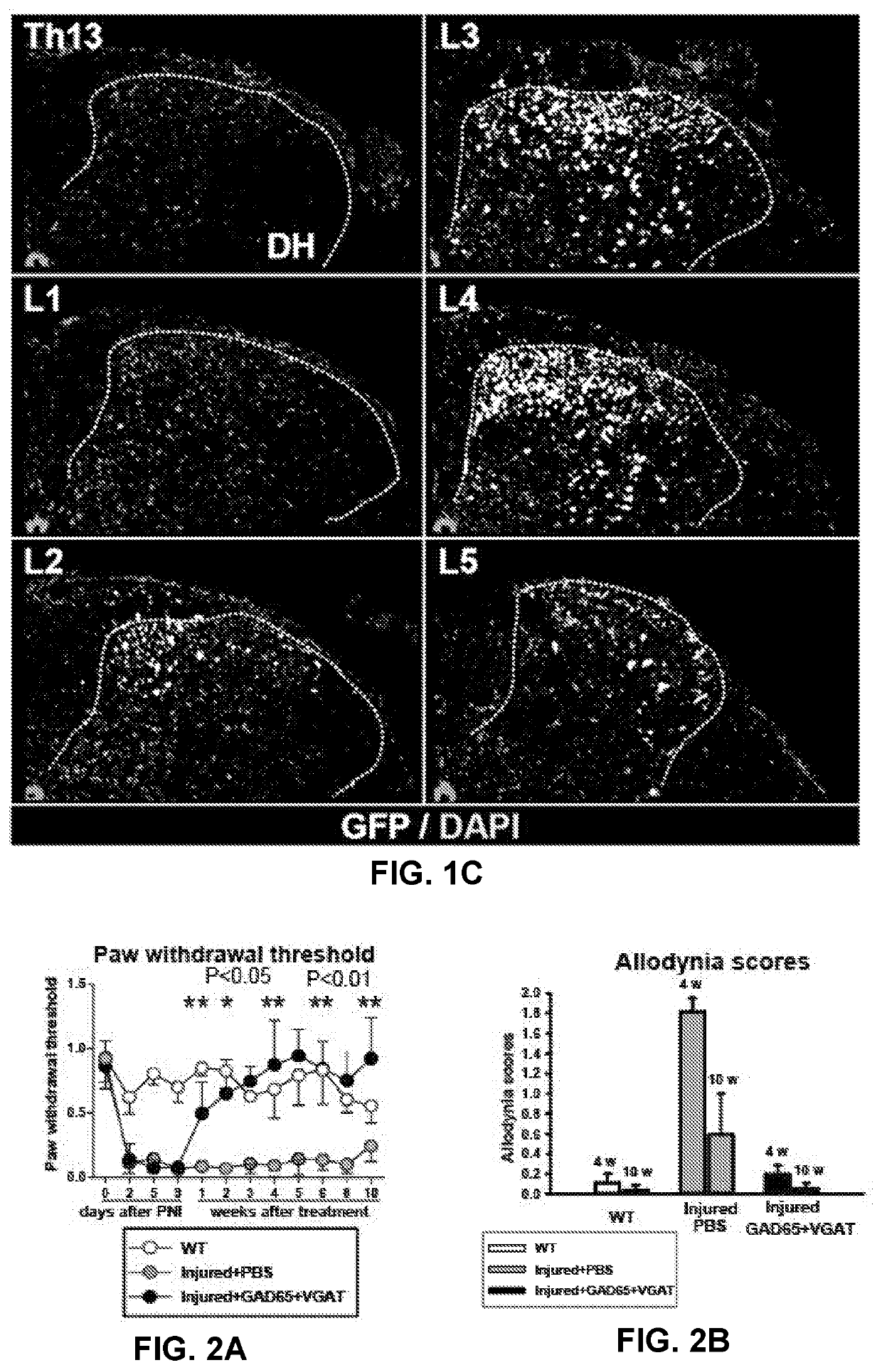 Method and composition for treating neuropathic pain