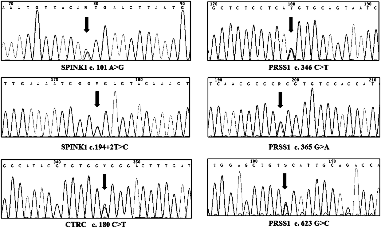 Application of set of gene mutation sites in preparation of reagent or kit for diagnosing chronic pancreatitis (CP) and evaluating prognosis