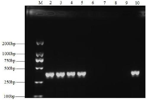 A kind of molecular detection primer and detection method of banana scab