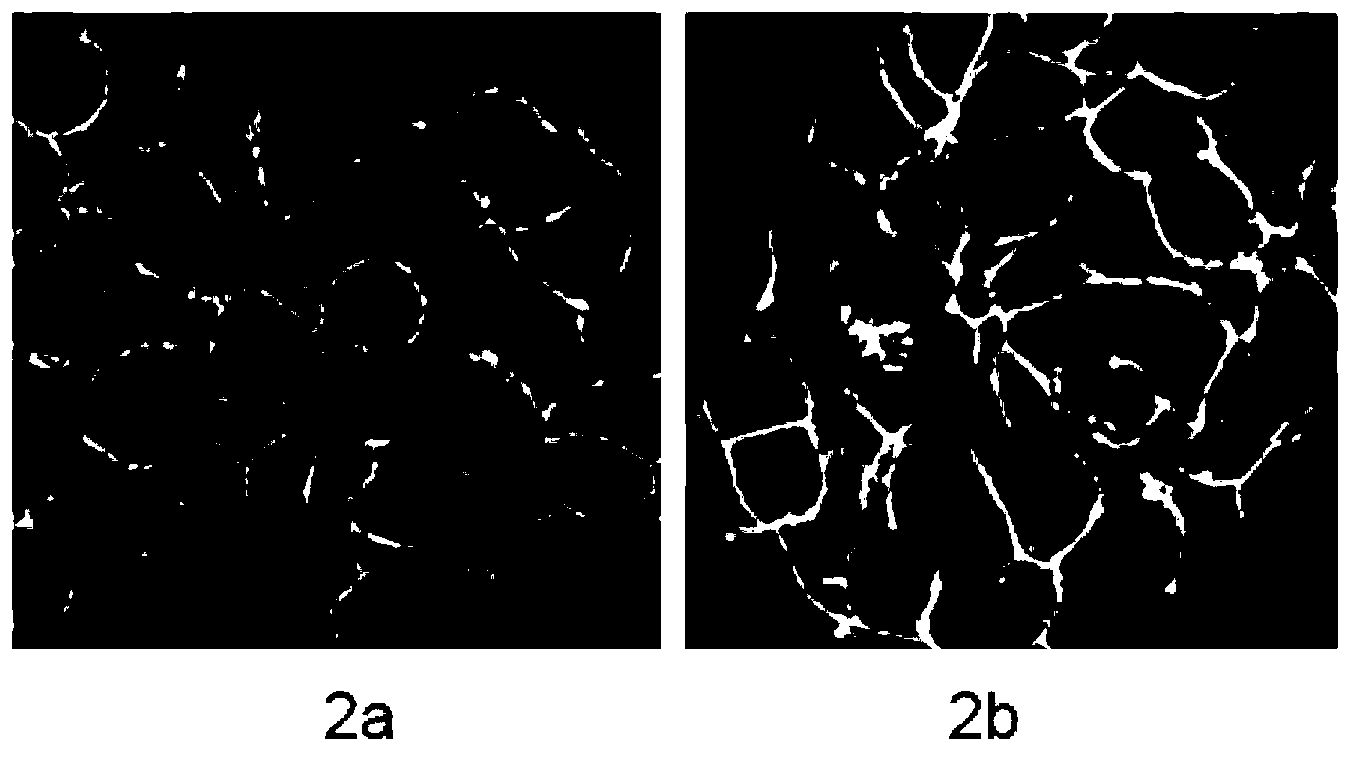 Tumour cell migration capability evaluation method and application