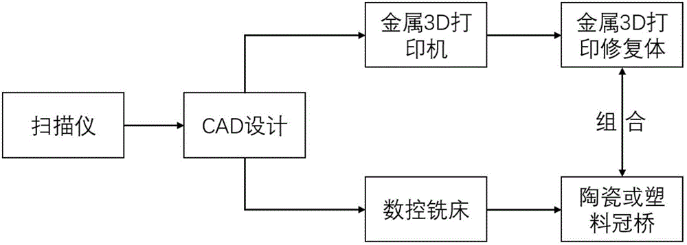 Dental prosthesis CAD/CAM/SLM-3D printing compound method