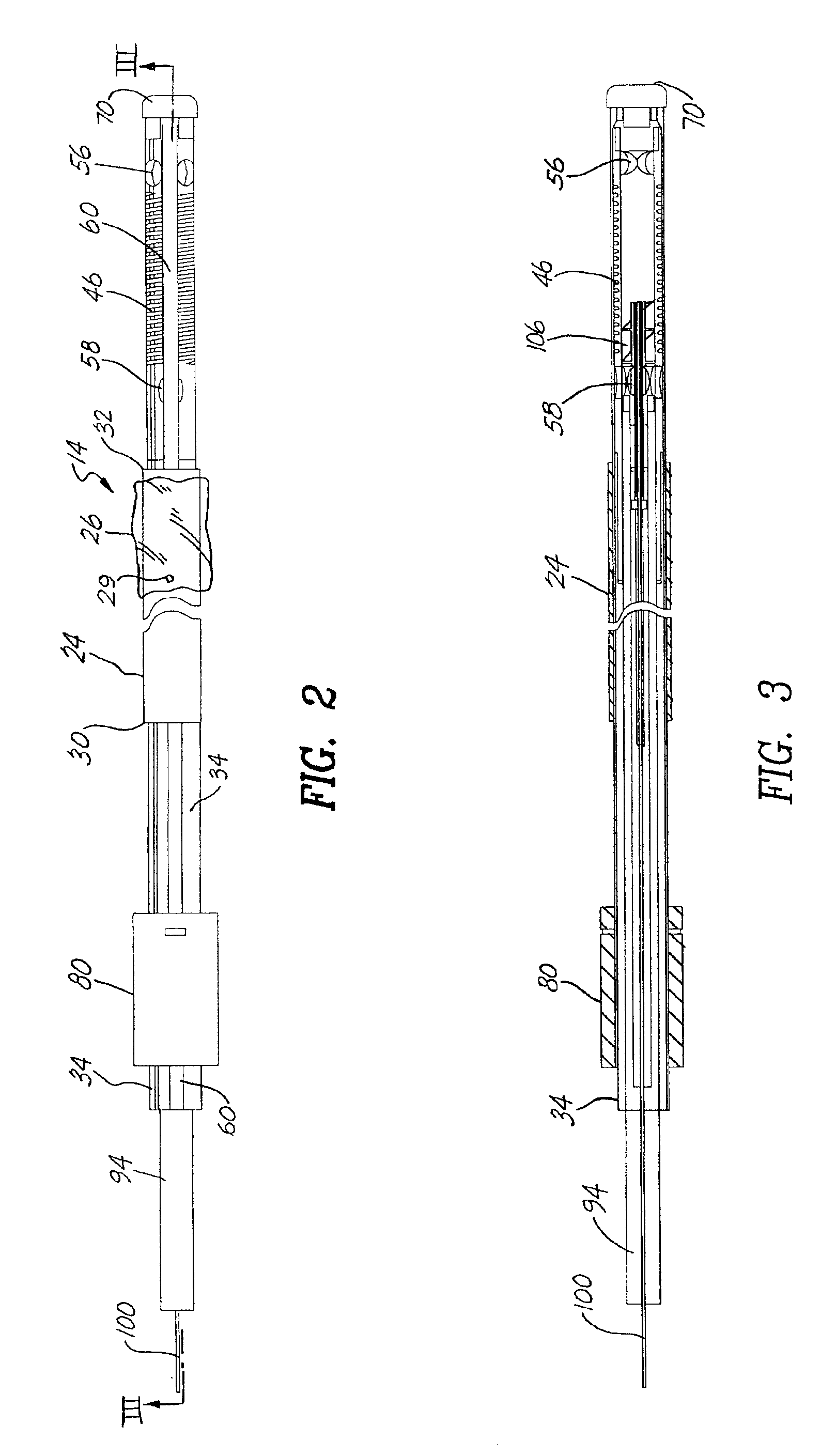 Thermal ablation with deployable cage