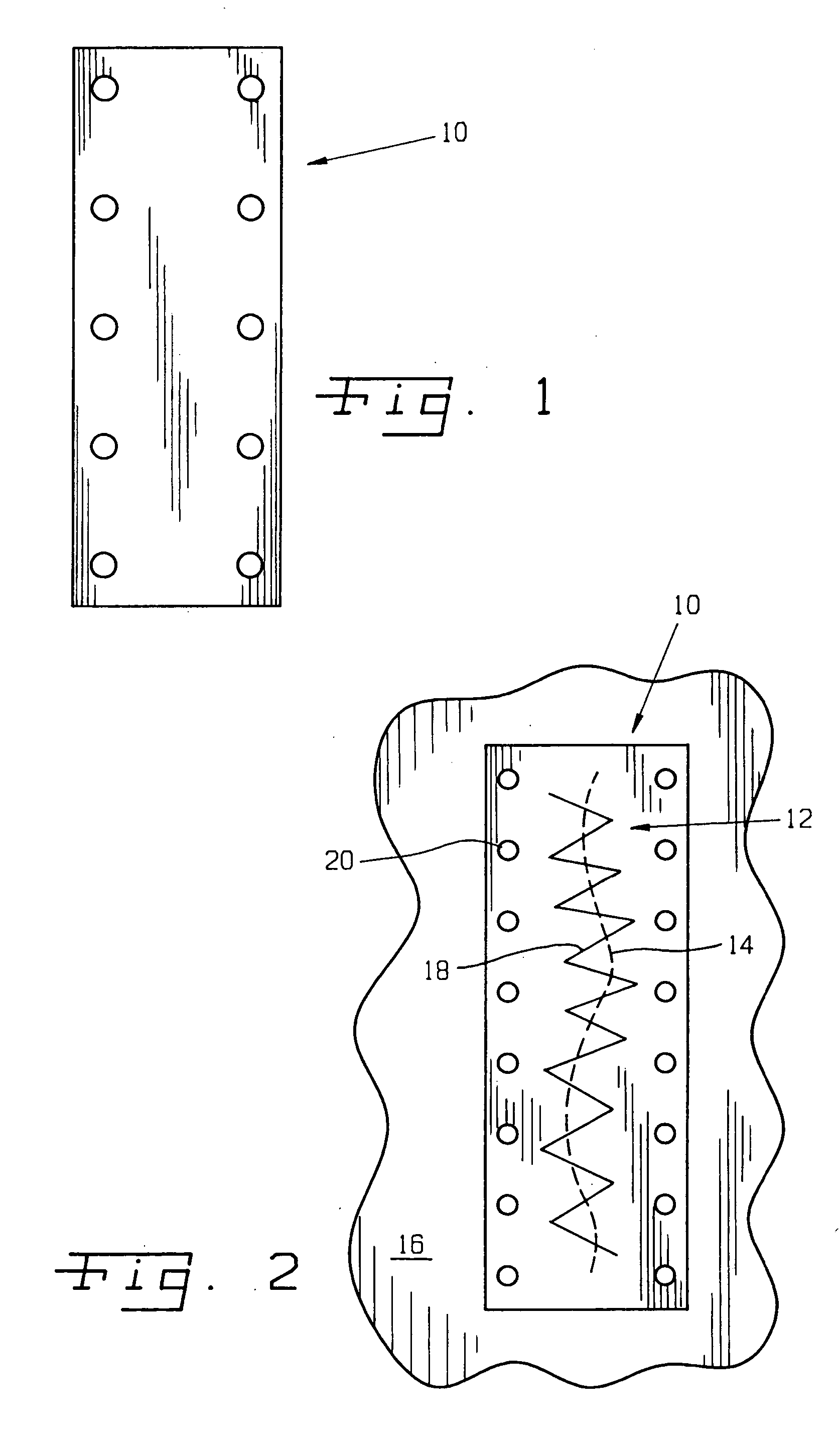 Surgical method and composition utilizing submucosal tissue to prevent incisional hernias