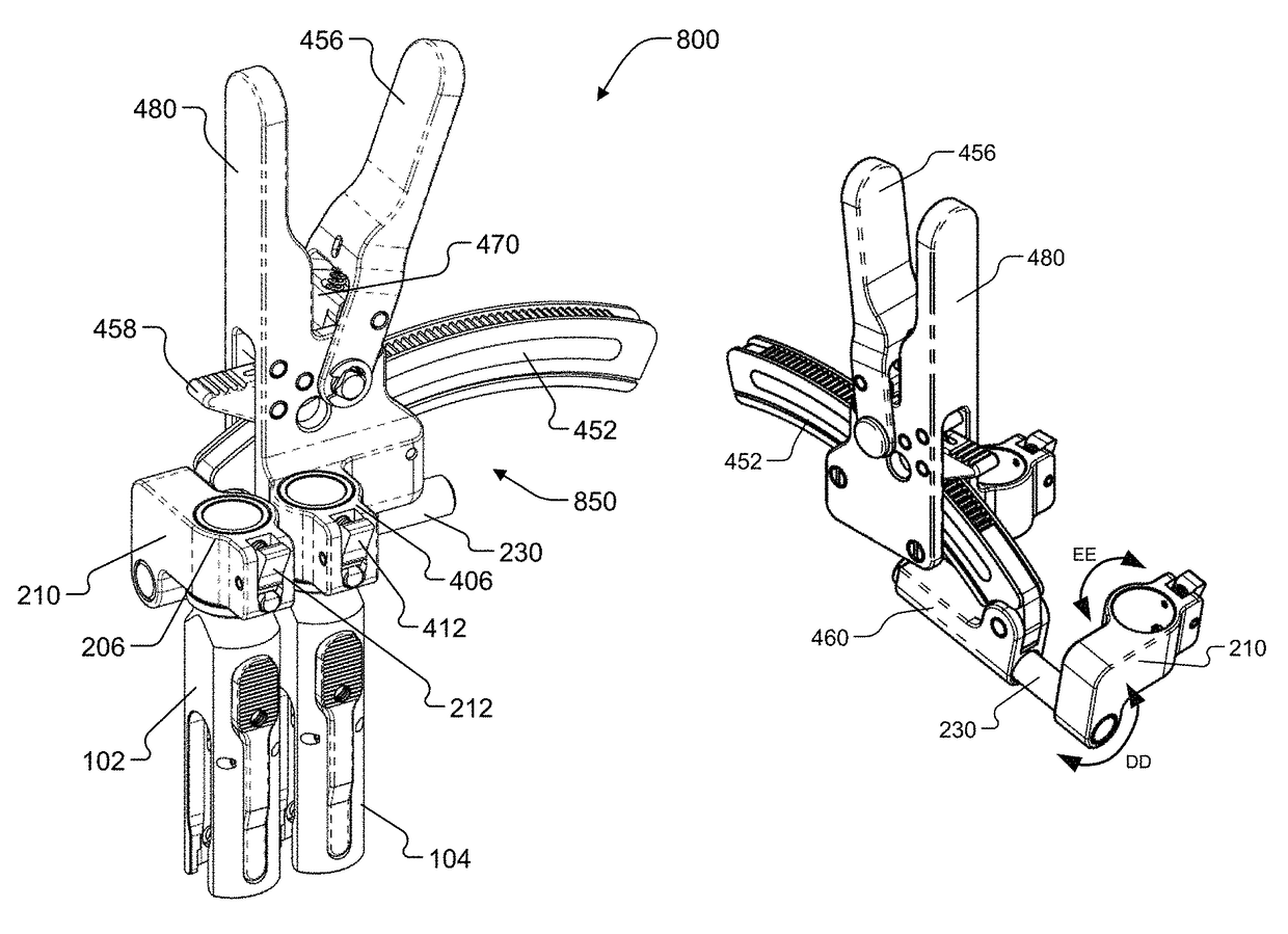 Spondylolisthesis reduction system