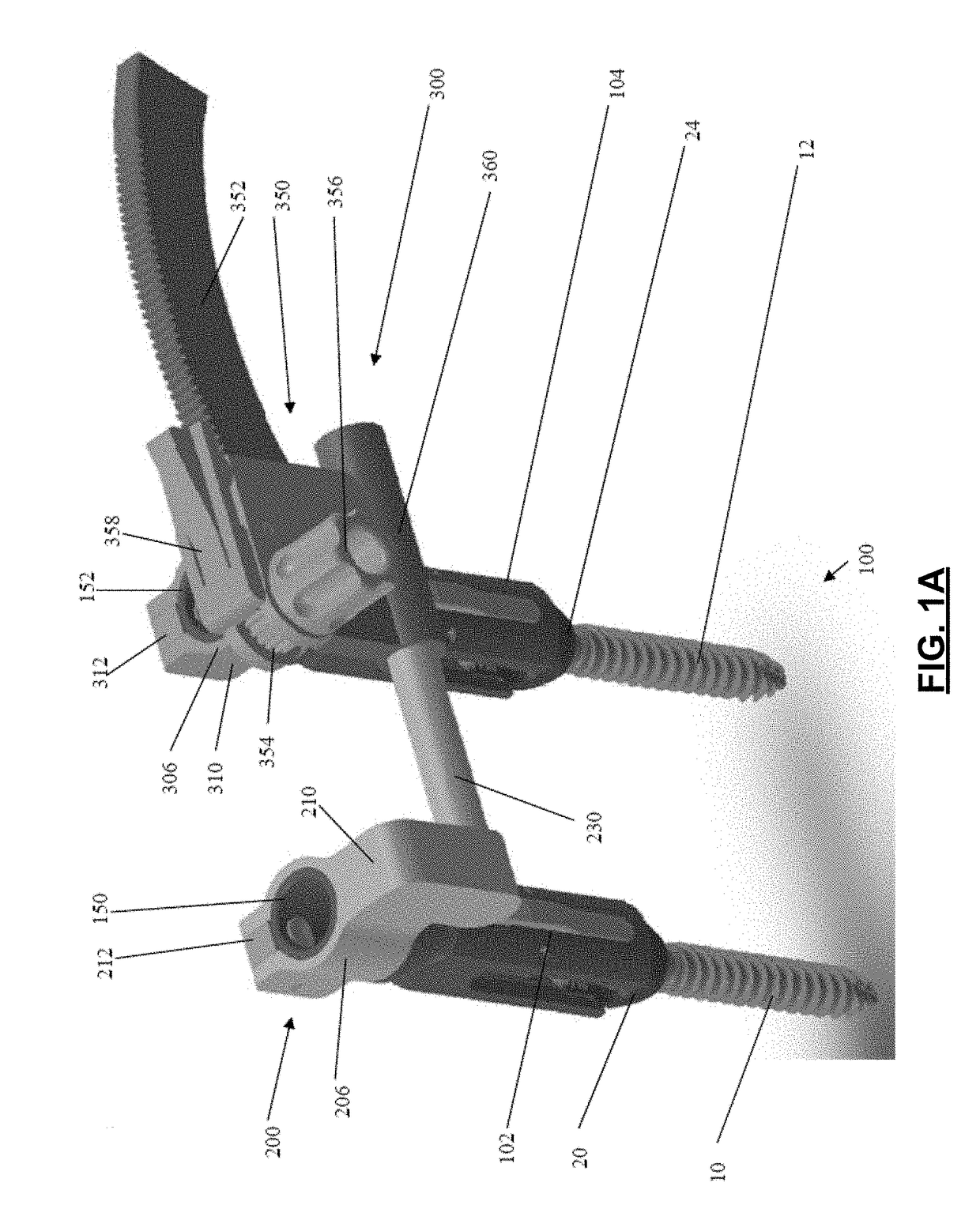 Spondylolisthesis reduction system