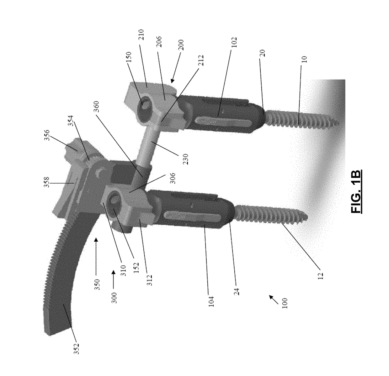 Spondylolisthesis reduction system