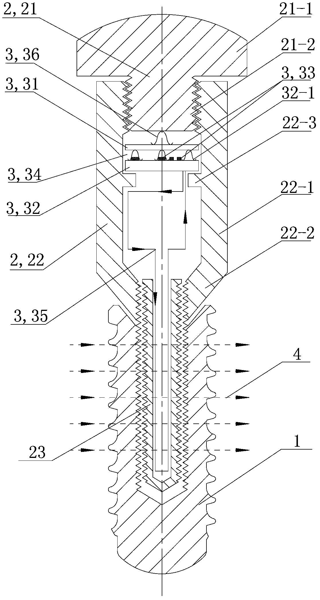 Electromagnetic stimulation dental implantation device