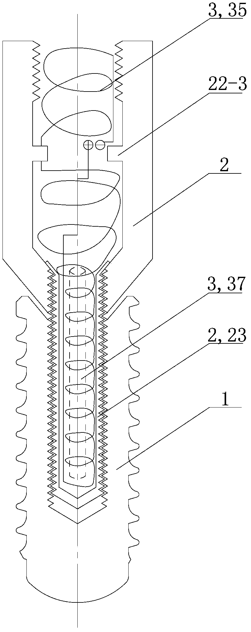 Electromagnetic stimulation dental implantation device