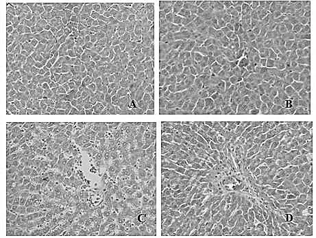 Application of canosic acid in preparing medicines used for preventing or treating diseases relating to liver injury