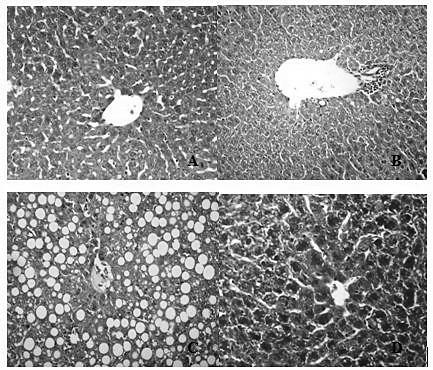 Application of canosic acid in preparing medicines used for preventing or treating diseases relating to liver injury