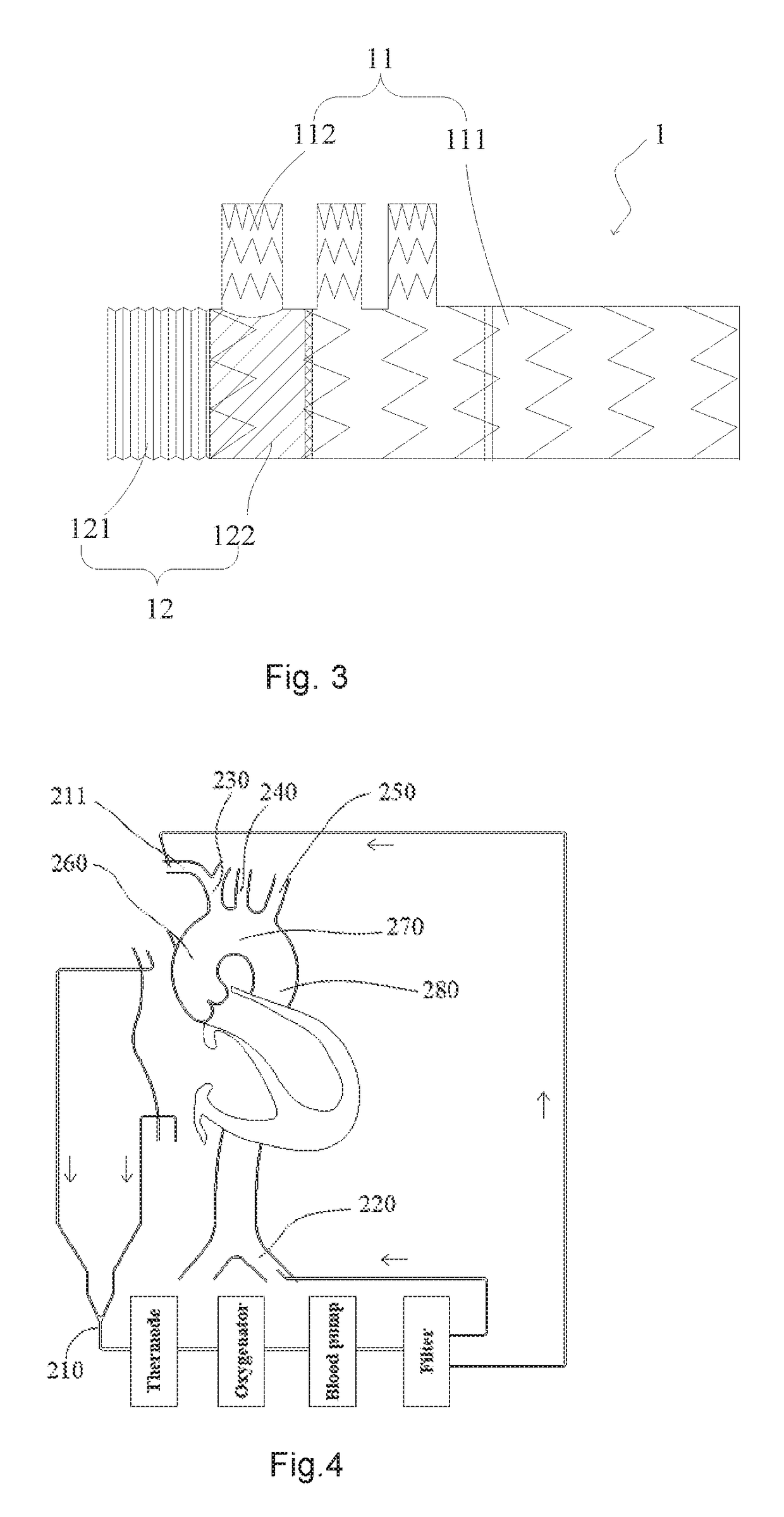 Method for treating aortic arch diseases