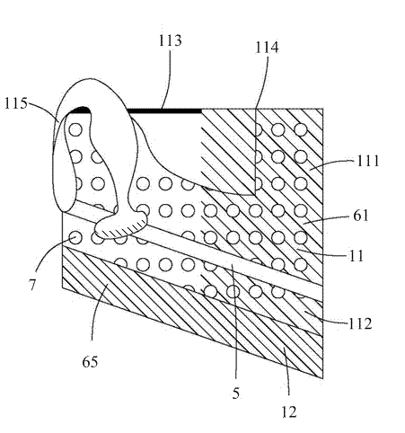 Artificial bionic nose stent