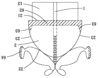 Artificial bionic nose stent