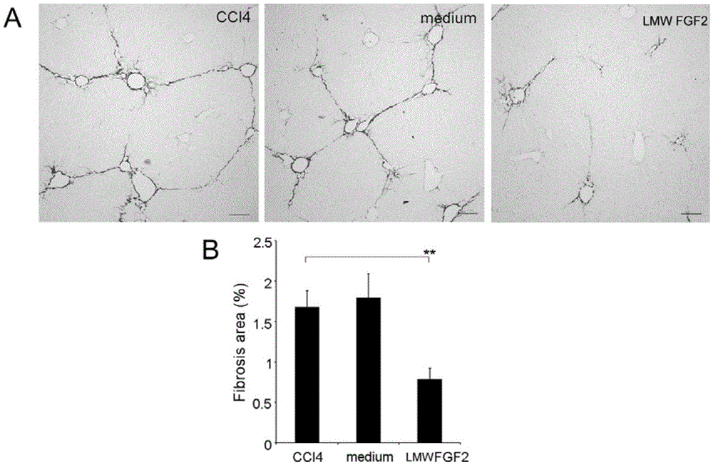 Application of low molecular weight basic fibroblast growth factor lmw FGF2