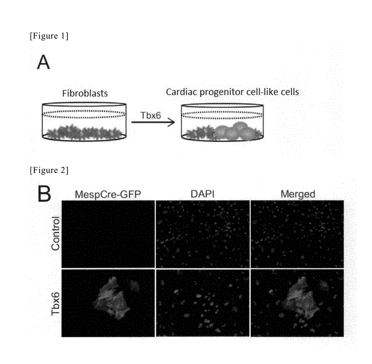 Method for directly producing cardiac precursor cell or myocardial cell from fibroblast