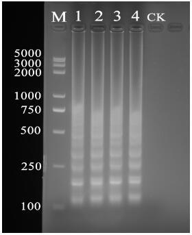 Loop-mediated isothermal amplification primer for rapidly detecting rotylenchulus reniformis and application of loop-mediated isothermal amplification primer