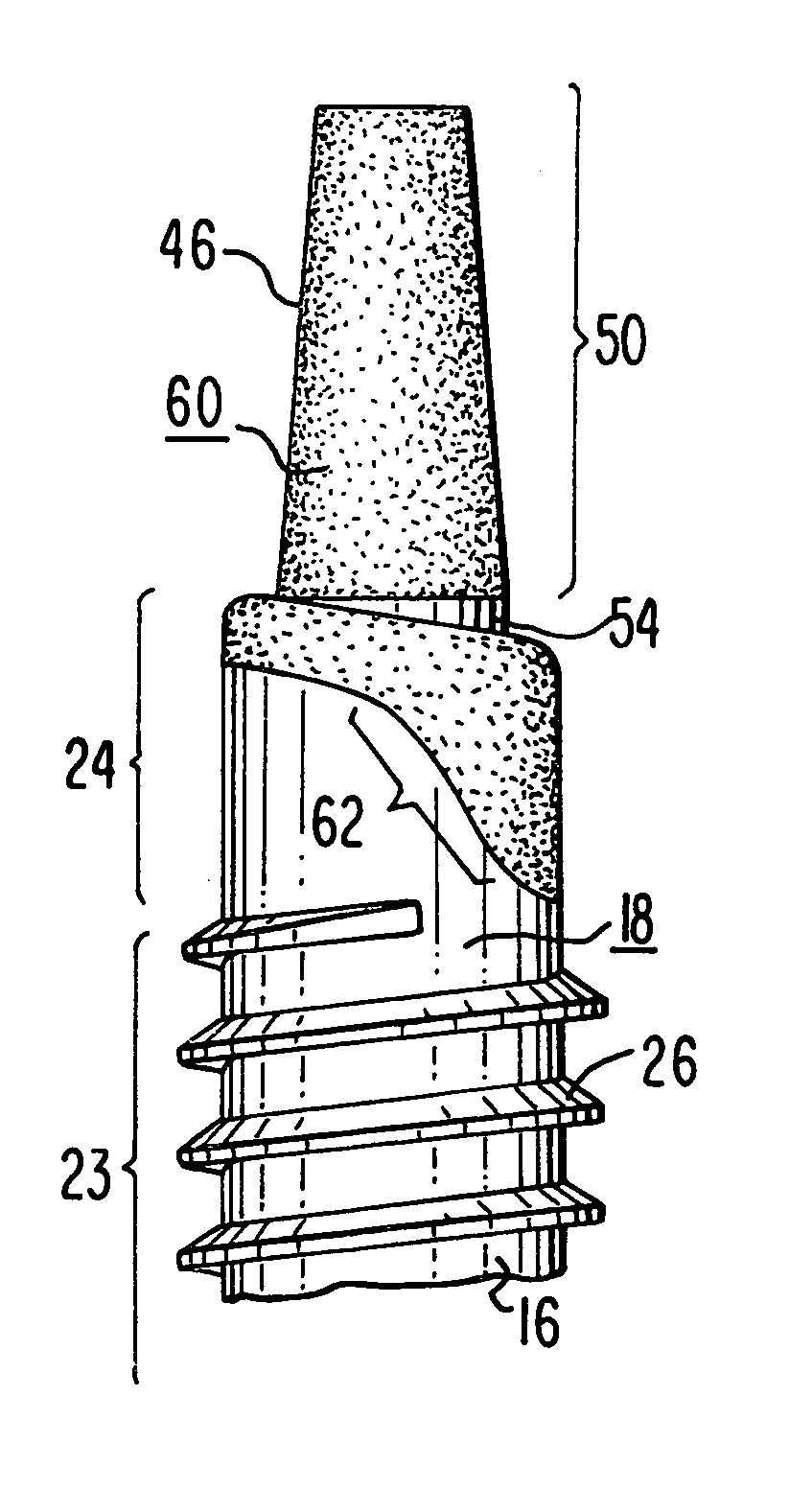 Aesthetic dental implant fixture and abutment system