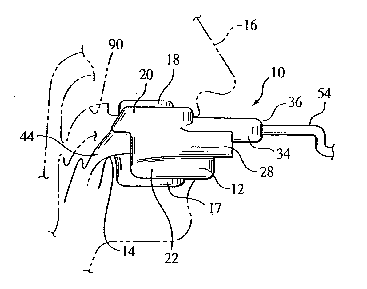 Intraoral apparatus for enhancing airway patency